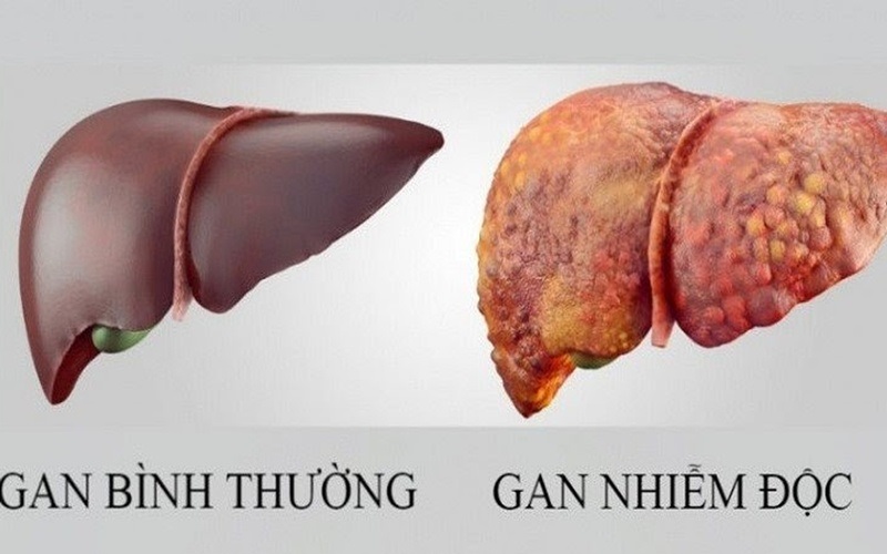 thuc-pham-mat-gan-giai-doc-5