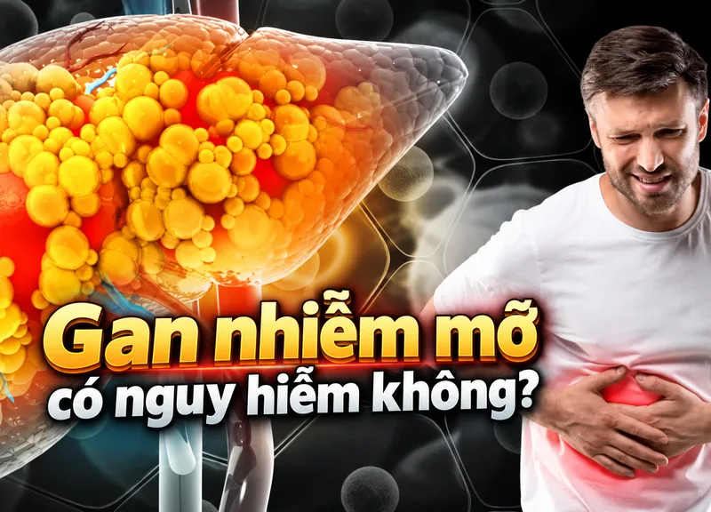 Gan nhiễm mỡ xảy ra khi lượng chất béo tích tụ quá mức trong tế bào gan, thường liên quan đến các rối loạn chuyển hóa.